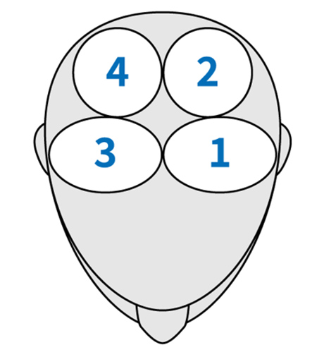 マイクロスコープ頭皮撮影場所